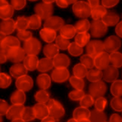 Experts Draft Guidelines For The Prevention Of Blood Clots In Multiple Myeloma Patients (IMW 2011)