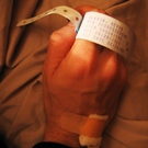 Study Offers New Insights About Matching Of Stem Cell Donors And Survival In MDS