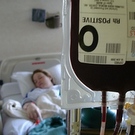 Iron-Reducing Therapy May Extend Lives Of MDS Patients