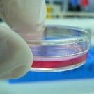 Gene Therapy Trial Reveals Possible Control Of HIV