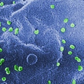 HIV Drug Resistance Rate Falls Significantly With Highly Active Antiretroviral Therapy