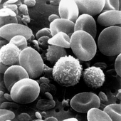 New Study Highlights Role Of Blood Clots In Multiple Myeloma Survival