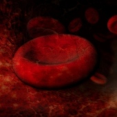 Red Blood Cell-Stimulating Agents May Improve Survival In Higher-Risk MDS Patients Receiving Vidaza