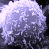 Study Suggests Targeting T Cells To Eradicate HIV