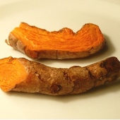 Curcumin May Reduce Free Light Chains In Patients With MGUS And Smoldering Multiple Myeloma