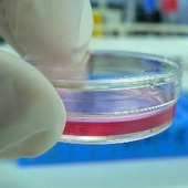 Gene Therapy Trial Reveals Possible Control Of HIV