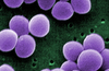 White Blood Cells Of MDS Patients Are Less Effective At Fighting Infections