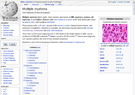 Wikipedia – Multiple myeloma